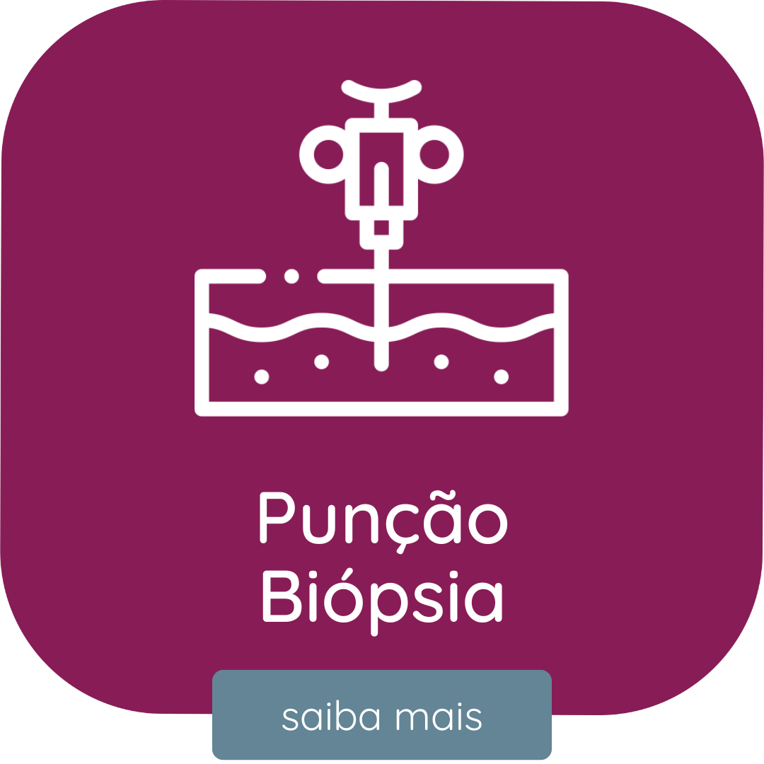 Exame de Biopsia
